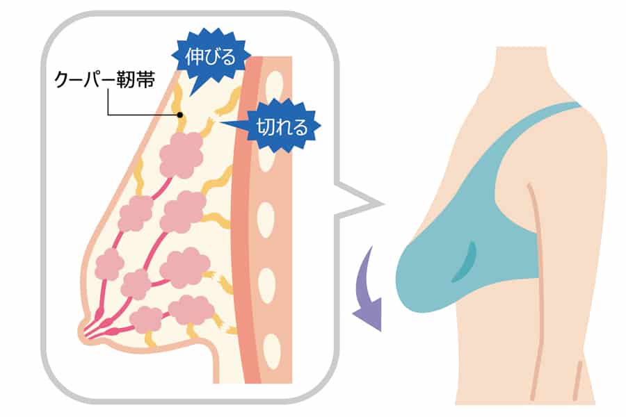 一般的に24歳から26歳ぐらいになると注意が必要です