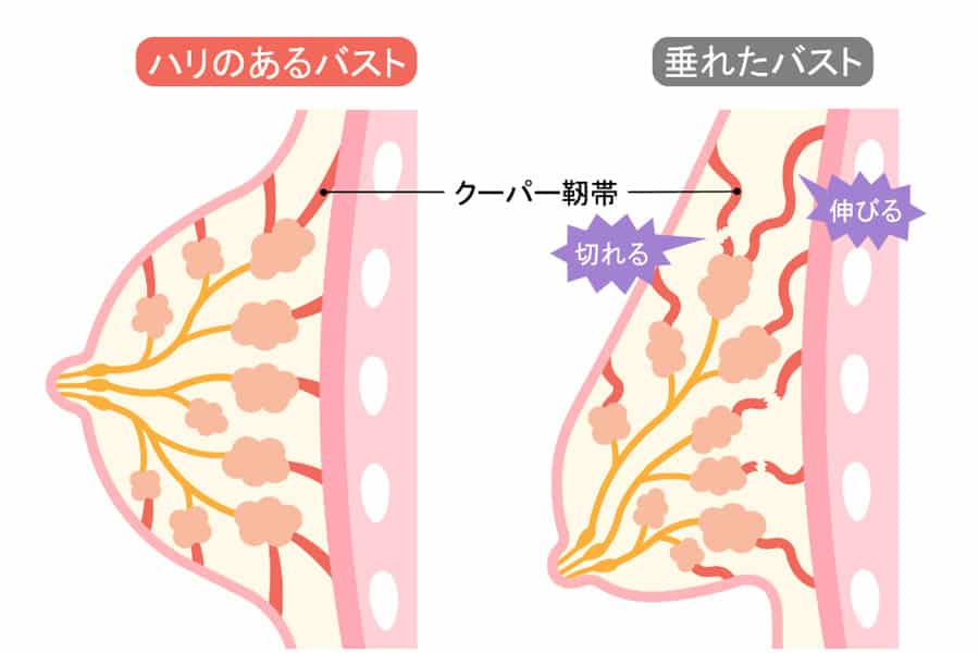 クーパー靭帯という組織がバストを支えています